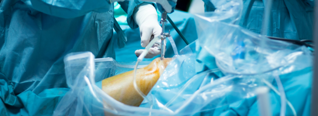 arthroscopic surgery