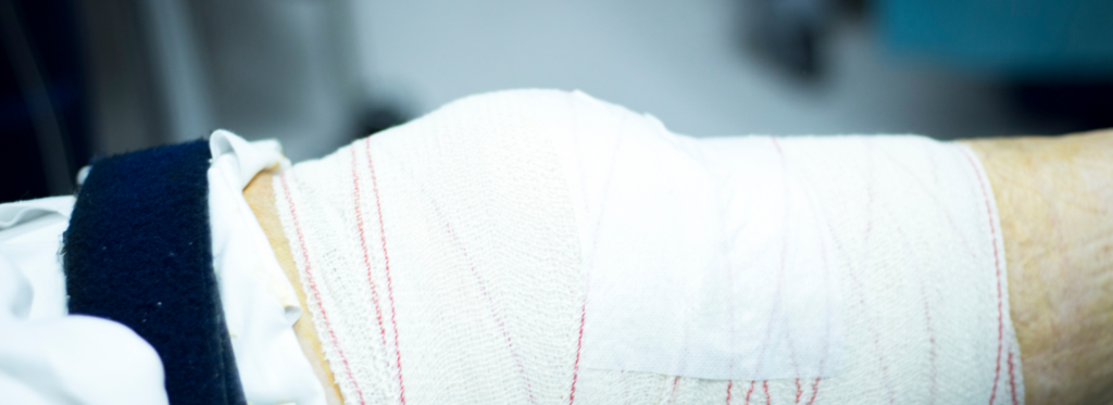 orthopedic treatments