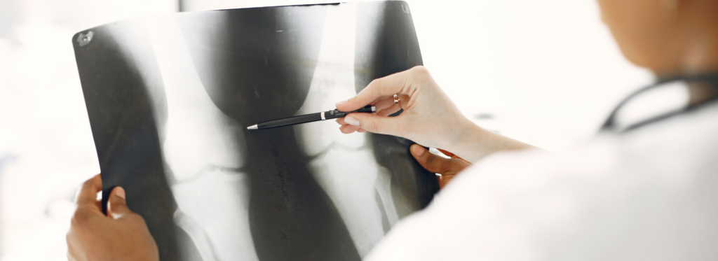 Orthopedic surgeries