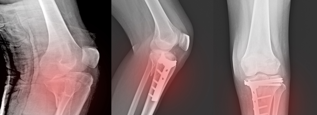 bones & joints