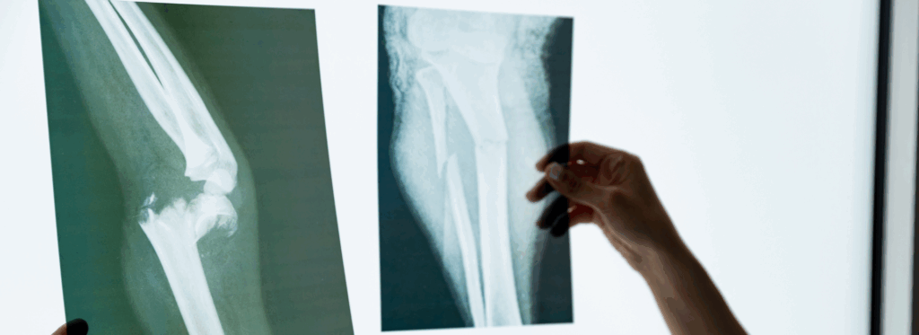 best orthopaedic hospital in Hyderabad